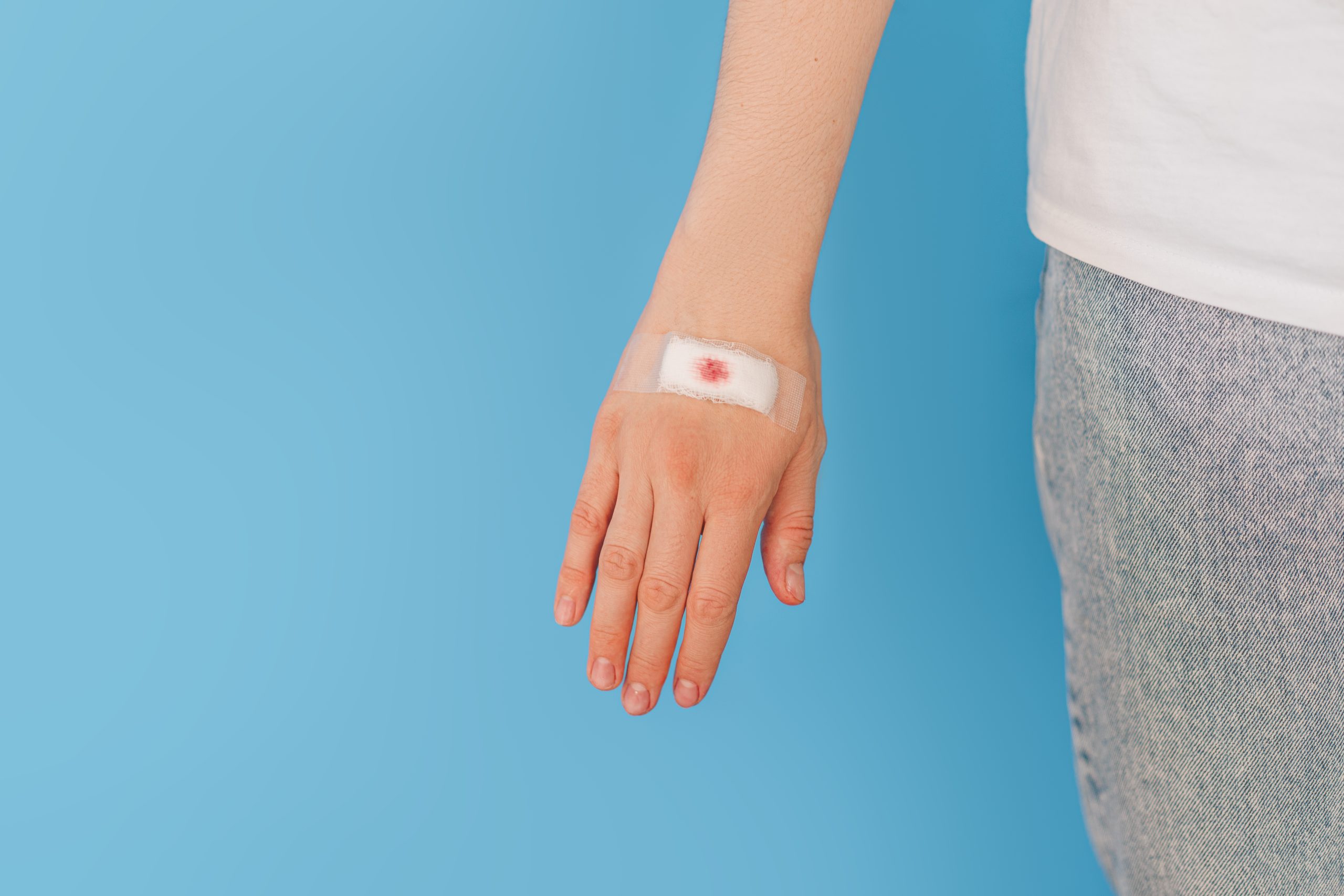Girl with plaster on the brush hand opposite the blue background